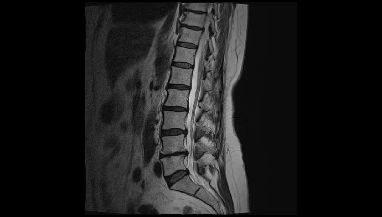 muguras sāpju diagnostika jostas rajonā