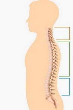 sakāve ar mugurkaula dažādu daļu osteohondrozi